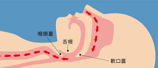 喉 が 狭く 感じる